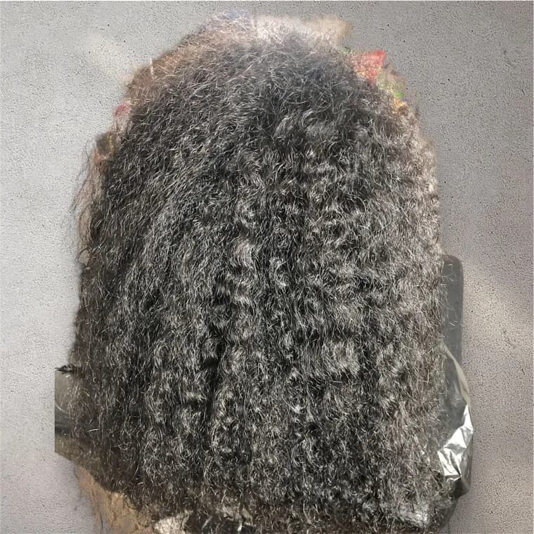 Nanoplastia, before the treatment