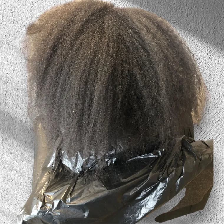 Nanoplastia, before the treatment